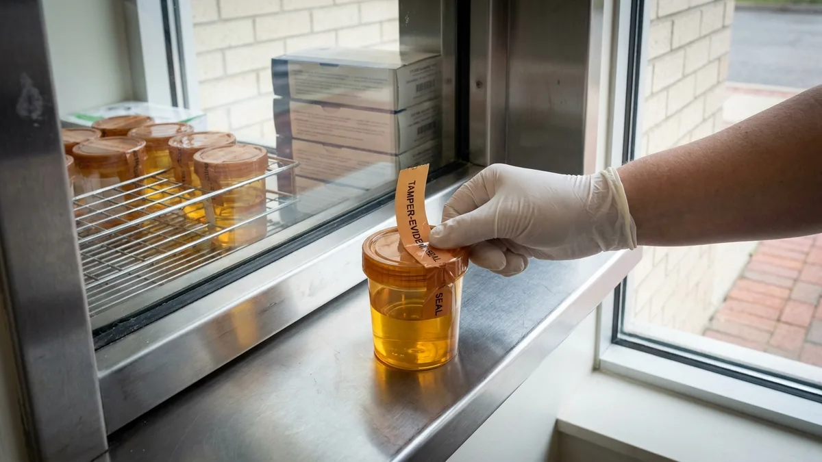 Sealed urine specimen cups lined up on a workplace drug-testing lab counter, gloved hand placing one, no legible labels in focus.